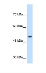 SPPL2B Antibody - Jurkat cell lysate. Antibody concentration: 1.0 ug/ml. Gel concentration: 8%.  This image was taken for the unconjugated form of this product. Other forms have not been tested.