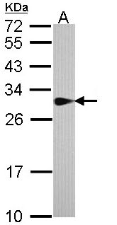 SPR Antibody - Sample (30 ug of whole cell lysate). A: A431 . 12% SDS PAGE. SPR antibody diluted at 1:1000.