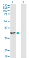 SPR Antibody - Western Blot analysis of SPR expression in transfected 293T cell line by SPR monoclonal antibody (M01), clone 4F2.Lane 1: SPR transfected lysate(28 KDa).Lane 2: Non-transfected lysate.