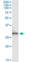 SPR Antibody - Immunoprecipitation of SPR transfected lysate using anti-SPR monoclonal antibody and Protein A Magnetic Bead, and immunoblotted with SPR rabbit polyclonal antibody.