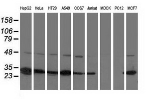 SPR Antibody - Western blot analysis of extracts (35ug) from 9 different cell lines by using anti-SPR monoclonal antibody.