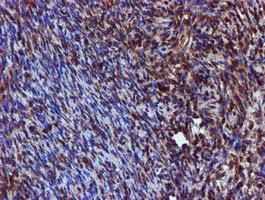 SPR Antibody - IHC of paraffin-embedded Human Ovary tissue using anti-SPR mouse monoclonal antibody.