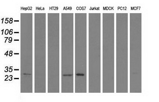 SPR Antibody - Western blot of extracts (35 ug) from 9 different cell lines by using anti-SPR monoclonal antibody.