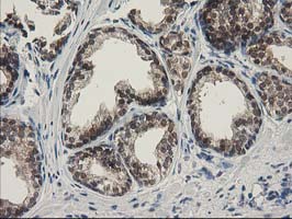 SPR Antibody - IHC of paraffin-embedded Human prostate tissue using anti-SPR mouse monoclonal antibody.