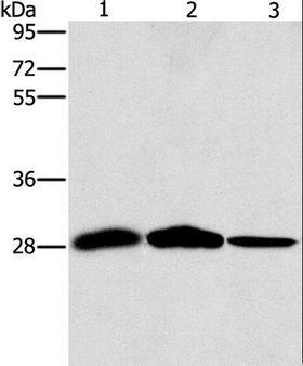 SPR Antibody - Western blot analysis of Mouse liver and human chromaffin cell tumor tissue, hepG2 cell, using SPR Polyclonal Antibody at dilution of 1:1500.