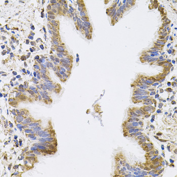 SPR Antibody - Immunohistochemistry of paraffin-embedded human lung tissue.
