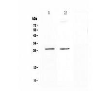 SPR Antibody - Western blot analysis of SPR using anti-SPR antibody