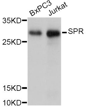 SPR Antibody - Western blot analysis of extracts of various cell lines, using SPR Antibody at 1:1000 dilution. The secondary antibody used was an HRP Goat Anti-Rabbit IgG (H+L) at 1:10000 dilution. Lysates were loaded 25ug per lane and 3% nonfat dry milk in TBST was used for blocking. An ECL Kit was used for detection and the exposure time was 3s.