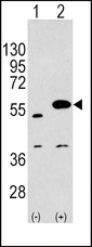 SPRED1 Antibody - Western blot of SPRED1 Antibody polyclonal antibody(arrow). 293 cell lysates (2 ug/lane) either nontransfected (Lane 1) or transiently transfected with the SPRED1 gene (Lane 2) (Origene Technologies).
