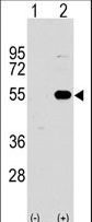 SPRED1 Antibody - Western blot of SPRED1 (arrow) using rabbit polyclonal SPRED1 Antibody. 293 cell lysates (2 ug/lane) either nontransfected (Lane 1) or transiently transfected with the SPRED1 gene (Lane 2) (Origene Technologies).