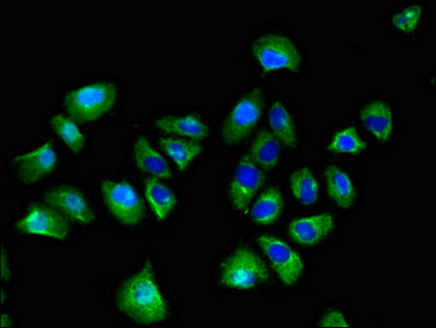 SPRED1 Antibody - Immunofluorescent analysis of A549 cells diluted at 1:100 and Alexa Fluor 488-congugated AffiniPure Goat Anti-Rabbit IgG(H+L)