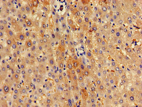 SPRED1 Antibody - Immunohistochemistry of paraffin-embedded human liver tissue at dilution of 1:100