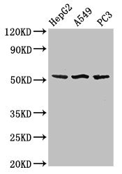 SPRED1 Antibody - Western Blot Positive WB detected in:HepG2 whole cell lysate,A549 whole cell lysate,PC3 whole cell lysate All Lanes:SPRED1 antibody at 3µg/ml Secondary Goat polyclonal to rabbit IgG at 1/50000 dilution Predicted band size: 51 KDa Observed band size: 51 KDa
