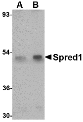 SPRED1 Antibody - Western blot of Spred1 in mouse brain tissue lysate with Spred1 antibody at (A) 1 and (B) 2 ug/ml.