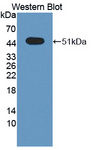 SPRED2 Antibody - Western blot of SPRED2 antibody.