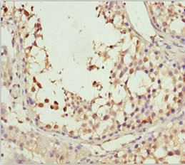 SPRED2 Antibody - Immunohistochemistry of paraffin-embedded human testis tissue at dilution 1:100