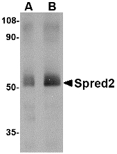 SPRED2 Antibody - Western blot of Spred2 in human small intestine tissue lysate with Spred2 antibody at (A) 1 and (B) 2 ug/ml