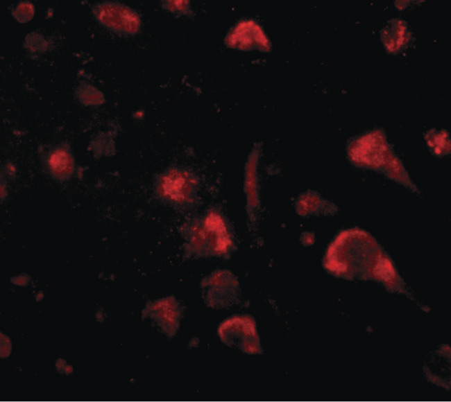 SPRED3 Antibody - Immunofluorescence of spred3 in human brain tissue with spred3 antibody at 20 ug/ml.
