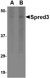 SPRED3 Antibody - Western blot of Spred3 in human brain tissue lysate with Spred3 antibody at (A) 2 and (B) 4 ug/ml