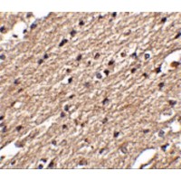 SPRED3 Antibody - Immunohistochemistry of Spred3 in human brain tissue with Spred3 antibody at 2.5 µg/mL.