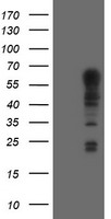 SPRING / TRIM9 Antibody - HEK293T cells were transfected with the pCMV6-ENTRY control (Left lane) or pCMV6-ENTRY TRIM9 (Right lane) cDNA for 48 hrs and lysed. Equivalent amounts of cell lysates (5 ug per lane) were separated by SDS-PAGE and immunoblotted with anti-TRIM9.