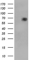 SPRING / TRIM9 Antibody - HEK293T cells were transfected with the pCMV6-ENTRY control (Left lane) or pCMV6-ENTRY TRIM9 (Right lane) cDNA for 48 hrs and lysed. Equivalent amounts of cell lysates (5 ug per lane) were separated by SDS-PAGE and immunoblotted with anti-TRIM9.