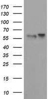 SPRING / TRIM9 Antibody - HEK293T cells were transfected with the pCMV6-ENTRY control (Left lane) or pCMV6-ENTRY TRIM9 (Right lane) cDNA for 48 hrs and lysed. Equivalent amounts of cell lysates (5 ug per lane) were separated by SDS-PAGE and immunoblotted with anti-TRIM9.