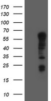 SPRING / TRIM9 Antibody - HEK293T cells were transfected with the pCMV6-ENTRY control (Left lane) or pCMV6-ENTRY TRIM9 (Right lane) cDNA for 48 hrs and lysed. Equivalent amounts of cell lysates (5 ug per lane) were separated by SDS-PAGE and immunoblotted with anti-TRIM9.