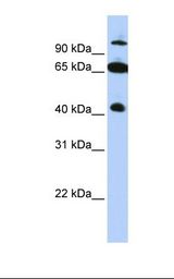SPRING / TRIM9 Antibody - HepG2 cell lysate. Antibody concentration: 1.0 ug/ml. Gel concentration: 12%.  This image was taken for the unconjugated form of this product. Other forms have not been tested.