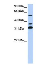 SPRING / TRIM9 Antibody - 721_B cell lysate. Antibody concentration: 1.0 ug/ml. Gel concentration: 12%.  This image was taken for the unconjugated form of this product. Other forms have not been tested.