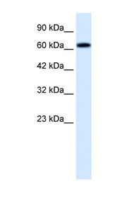SPRING / TRIM9 Antibody - TRIM9 antibody Western blot of HepG2 cell lysate. This image was taken for the unconjugated form of this product. Other forms have not been tested.