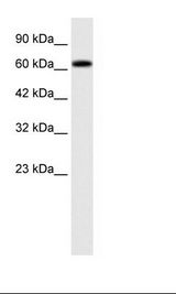 SPRING / TRIM9 Antibody - HepG2 Cell Lysate.  This image was taken for the unconjugated form of this product. Other forms have not been tested.