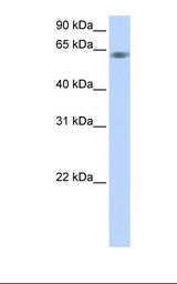 SPRING / TRIM9 Antibody - Fetal muscle lysate. Antibody concentration: 1.0 ug/ml. Gel concentration: 12%.  This image was taken for the unconjugated form of this product. Other forms have not been tested.