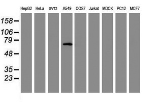 SPRING / TRIM9 Antibody - Western blot of extracts (35 ug) from 9 different cell lines by using g anti-TRIM9 monoclonal antibody (HepG2: human; HeLa: human; SVT2: mouse; A549: human; COS7: monkey; Jurkat: human; MDCK: canine; PC12: rat; MCF7: human).