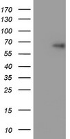 SPRING / TRIM9 Antibody - HEK293T cells were transfected with the pCMV6-ENTRY control (Left lane) or pCMV6-ENTRY TRIM9 (Right lane) cDNA for 48 hrs and lysed. Equivalent amounts of cell lysates (5 ug per lane) were separated by SDS-PAGE and immunoblotted with anti-TRIM9.