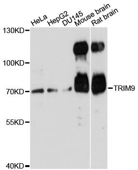 SPRING / TRIM9 Antibody - Western blot analysis of extracts of various cell lines, using TRIM9 antibody at 1:3000 dilution. The secondary antibody used was an HRP Goat Anti-Rabbit IgG (H+L) at 1:10000 dilution. Lysates were loaded 25ug per lane and 3% nonfat dry milk in TBST was used for blocking. An ECL Kit was used for detection and the exposure time was 90s.