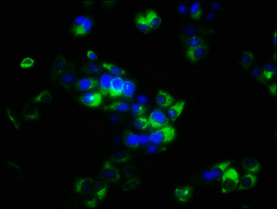 Sprouty 4 / SPRY4 Antibody - Immunofluorescence staining of PC-3 cells with SPRY4 Antibody at 1:266, counter-stained with DAPI. The cells were fixed in 4% formaldehyde, permeabilized using 0.2% Triton X-100 and blocked in 10% normal Goat Serum. The cells were then incubated with the antibody overnight at 4°C. The secondary antibody was Alexa Fluor 488-congugated AffiniPure Goat Anti-Rabbit IgG(H+L).