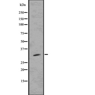 Sprouty 4 / SPRY4 Antibody - Western blot analysis of prouty 4 using K562 whole cells lysates