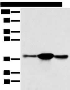 Sprouty 4 / SPRY4 Antibody - Western blot analysis of K562 A375 and 231 cell  using SPRY4 Polyclonal Antibody at dilution of 1:400