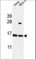 SPRR1A Antibody - SPRR1A Antibody western blot of Jurkat,MCF-7 cell line lysates (35 ug/lane). The SPRR1A antibody detected the SPRR1A protein (arrow).