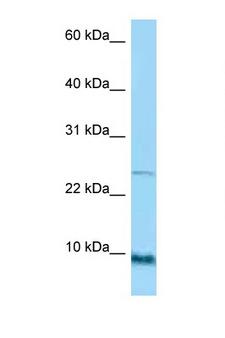 SPRR1A Antibody - SPRR1A antibody Western blot of HT1080 Cell lysate. Antibody concentration 1 ug/ml.  This image was taken for the unconjugated form of this product. Other forms have not been tested.