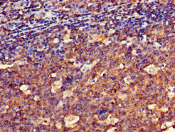 SPRR1A Antibody - Immunohistochemistry of paraffin-embedded human tonsil tissue using SPRR1A Antibody at dilution of 1:100