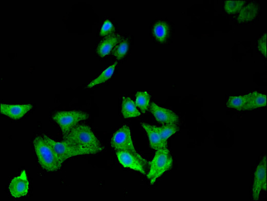 SPRR1A Antibody - Immunofluorescent analysis of HepG2 cells using SPRR1A Antibody at a dilution of 1:100 and Alexa Fluor 488-congugated AffiniPure Goat Anti-Rabbit IgG(H+L)