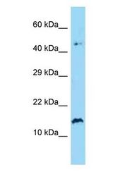 SPRR2A Antibody - SPRR2A antibody Western Blot of Human Jurkat. Antibody dilution: 1 ug/ml.  This image was taken for the unconjugated form of this product. Other forms have not been tested.