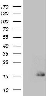 SPRR2A Antibody - HEK293T cells were transfected with the pCMV6-ENTRY control. (Left lane) or pCMV6-ENTRY SPRR2A. (Right lane) cDNA for 48 hrs and lysed. Equivalent amounts of cell lysates. (5 ug per lane) were separated by SDS-PAGE and immunoblotted with anti-SPRR2A. (1:2000)