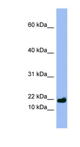 SPRR3 Antibody - SPRR3 antibody Western blot of NCI-H226 cell lysate. This image was taken for the unconjugated form of this product. Other forms have not been tested.