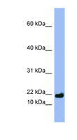 SPRR3 Antibody - SPRR3 antibody Western blot of NCI-H226 cell lysate. This image was taken for the unconjugated form of this product. Other forms have not been tested.
