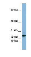 SPRR3 Antibody - SPRR3 antibody Western blot of HT1080 cell lysate. This image was taken for the unconjugated form of this product. Other forms have not been tested.