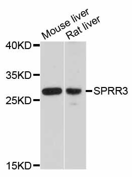 SPRR3 Antibody - Western blot analysis of extracts of various cell lines, using SPRR3 antibody at 1:3000 dilution. The secondary antibody used was an HRP Goat Anti-Rabbit IgG (H+L) at 1:10000 dilution. Lysates were loaded 25ug per lane and 3% nonfat dry milk in TBST was used for blocking. An ECL Kit was used for detection and the exposure time was 90s.