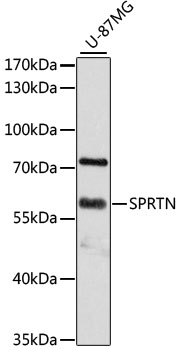 SPRTN / C1orf124 Antibody - Western blot analysis of extracts of U-87MG cells, using SPRTN antibody at 1:3000 dilution. The secondary antibody used was an HRP Goat Anti-Rabbit IgG (H+L) at 1:10000 dilution. Lysates were loaded 25ug per lane and 3% nonfat dry milk in TBST was used for blocking. An ECL Kit was used for detection and the exposure time was 60s.